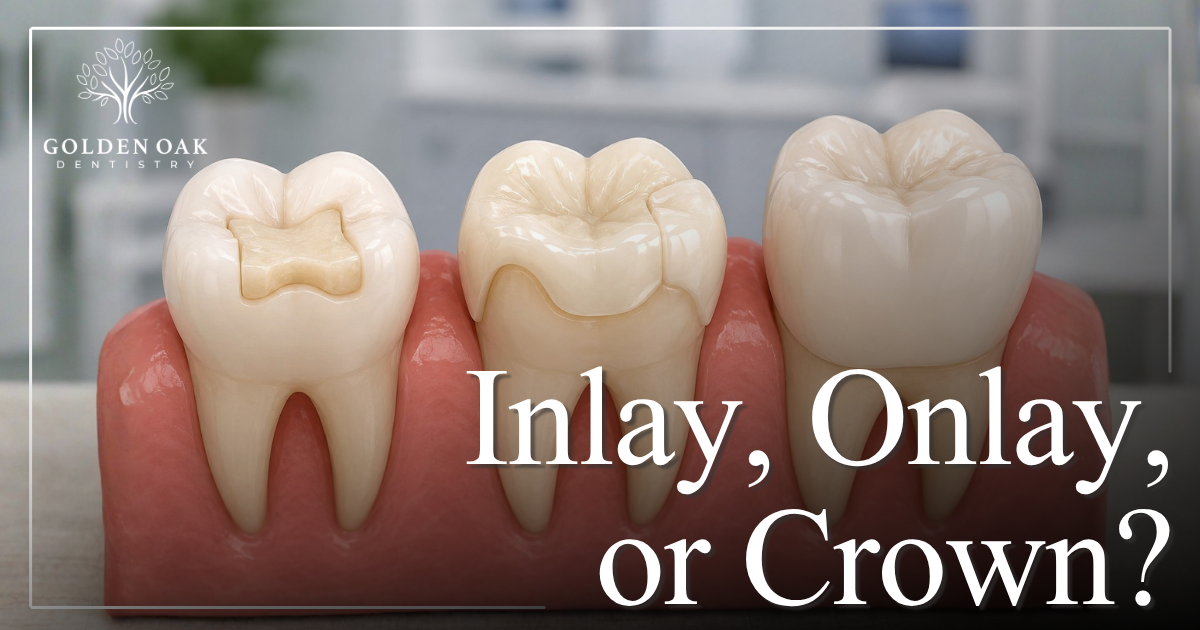 Inlay, Onlay, or Crown?